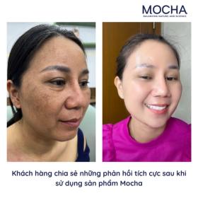  Thương hiệu Mocha - Tự hào mỹ phẩm Việt chất lượng Quốc tế 